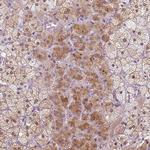 KRT71 Antibody in Immunohistochemistry (Paraffin) (IHC (P))