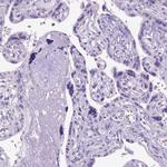 KRT71 Antibody in Immunohistochemistry (Paraffin) (IHC (P))