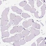 KRT71 Antibody in Immunohistochemistry (Paraffin) (IHC (P))