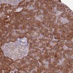 DAND5 Polyclonal Antibody