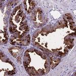 OR4C5 Polyclonal Antibody