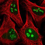 PAPSS1 Antibody in Immunocytochemistry (ICC/IF)