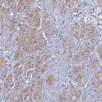 PAPSS1 Antibody in Immunohistochemistry (Paraffin) (IHC (P))
