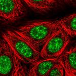 TCF3 Polyclonal Antibody