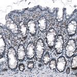 TCF3 Antibody in Immunohistochemistry (Paraffin) (IHC (P))