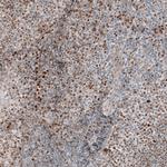 TCF3 Antibody in Immunohistochemistry (Paraffin) (IHC (P))