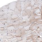 TCF3 Antibody in Immunohistochemistry (Paraffin) (IHC (P))