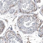 TCF3 Antibody in Immunohistochemistry (Paraffin) (IHC (P))