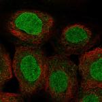 POM121 Polyclonal Antibody