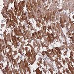 POM121 Antibody in Immunohistochemistry (Paraffin) (IHC (P))