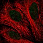 PFKFB2 Polyclonal Antibody