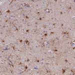 PFKFB2 Antibody in Immunohistochemistry (Paraffin) (IHC (P))