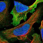 NG2 Polyclonal Antibody