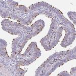 CD80 Antibody in Immunohistochemistry (Paraffin) (IHC (P))