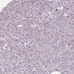 CD80 Antibody in Immunohistochemistry (Paraffin) (IHC (P))