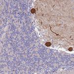 CYLD Antibody in Immunohistochemistry (Paraffin) (IHC (P))