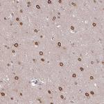 RANGAP1 Antibody in Immunohistochemistry (Paraffin) (IHC (P))