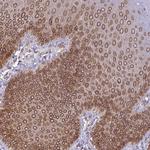 RANGAP1 Antibody in Immunohistochemistry (Paraffin) (IHC (P))