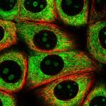 RPL8 Polyclonal Antibody