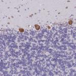 RPL8 Antibody in Immunohistochemistry (Paraffin) (IHC (P))