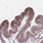 RPL8 Antibody in Immunohistochemistry (Paraffin) (IHC (P))