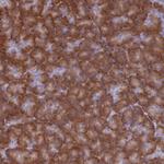 RPL8 Antibody in Immunohistochemistry (Paraffin) (IHC (P))