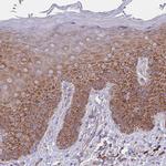 RPL8 Antibody in Immunohistochemistry (Paraffin) (IHC (P))