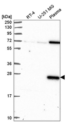 Dectin 1 (soluble) Antibody in Western Blot (WB)