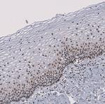 SF3B1 Antibody in Immunohistochemistry (Paraffin) (IHC (P))