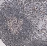 SF3B1 Antibody in Immunohistochemistry (Paraffin) (IHC (P))