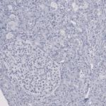SF3B1 Antibody in Immunohistochemistry (Paraffin) (IHC (P))