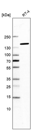 SF3B1 Antibody in Western Blot (WB)