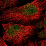 ATG16L2 Polyclonal Antibody