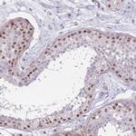 SIN3B Antibody in Immunohistochemistry (Paraffin) (IHC (P))