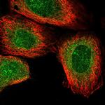 NANP Polyclonal Antibody