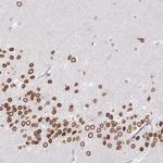 NANP Antibody in Immunohistochemistry (Paraffin) (IHC (P))