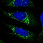 PLD5 Polyclonal Antibody