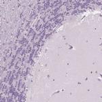 NOLC1 Antibody in Immunohistochemistry (Paraffin) (IHC (P))