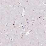 NOLC1 Antibody in Immunohistochemistry (Paraffin) (IHC (P))