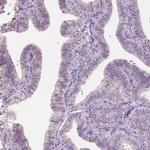 NOLC1 Antibody in Immunohistochemistry (Paraffin) (IHC (P))