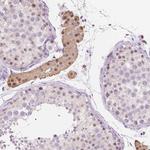 NOLC1 Antibody in Immunohistochemistry (Paraffin) (IHC (P))
