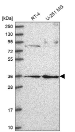 RPP38 Antibody in Western Blot (WB)