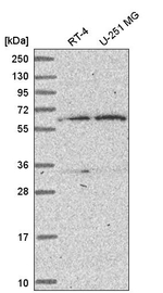 TBRG4 Antibody in Western Blot (WB)