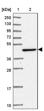 HSDL2 Antibody in Western Blot (WB)