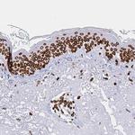 Lamin B1 Antibody in Immunohistochemistry (Paraffin) (IHC (P))