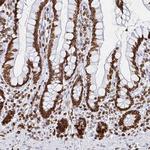 Lamin B1 Antibody in Immunohistochemistry (Paraffin) (IHC (P))