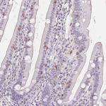 CD69 Antibody in Immunohistochemistry (Paraffin) (IHC (P))