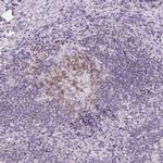 CD69 Antibody in Immunohistochemistry (Paraffin) (IHC (P))
