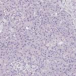CD69 Antibody in Immunohistochemistry (Paraffin) (IHC (P))