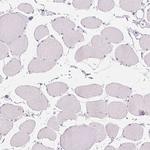 CD69 Antibody in Immunohistochemistry (Paraffin) (IHC (P))